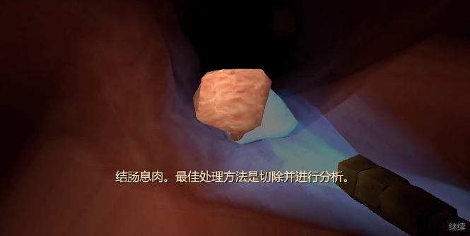 大肠的复仇游戏攻略